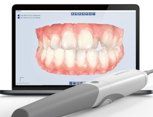 La rivoluzione tecnologica dell’odontoiatria: radiologia digitale e scanner intraorali